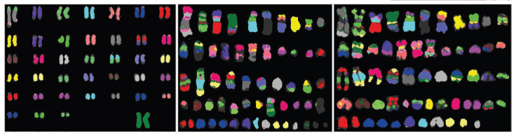 Chromosomes from domestic dog (left) and the two tumor cells lines from Australia and South America. The colors show equivalent portions of the genome.  Mixtures of colors on the cancere chromosomes indicate that the chromosomes have been scrabbled up with pieces of DNA from one being moved to other chromosomes.  This is part of a figure from Merchinson et al. in Science which discusses the genome results.  See references for details. 
