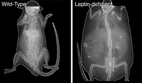Bone density scans showing difference in body composition in wild-type (left panel) and leptin-deficient (right panel) mice. (Sebastian Bouret, Ph.D. / University of Southern California)