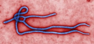 The Ebola Virus. Like most viruses, the Ebola virus is not a cell but rather just a protein capsule with a very small genome (a single strand of RNA in this case rather than DNA as found in all "living" things).