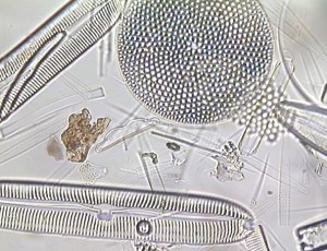 Several species of diatoms viewed under a light microscope. It is the glass housing that forms the shapes that you see here.