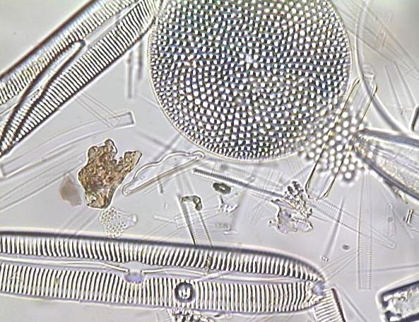 Several species of diatoms viewed under a light microscope.  It is the glass housing that forms the shapes that you see here.